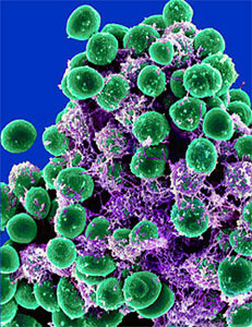Staphylococcus Epidermidis therapy